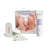 Calluspeeling 12-Treatment Refill Kit